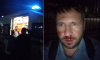 Воронежский наблюдатель заявил об избиении возле избирательного участка