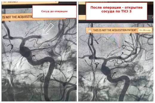 «Заговорила прямо на операционном столе»: врачи вернули женщине дар речи в Воронежской области
